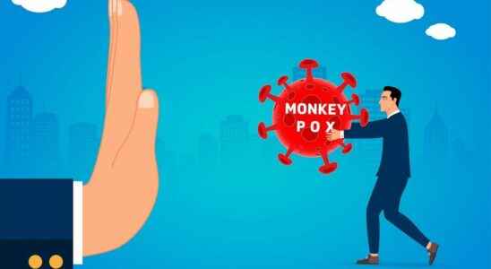 Monkeypox CDC rules out airborne transmission of Monkeypox