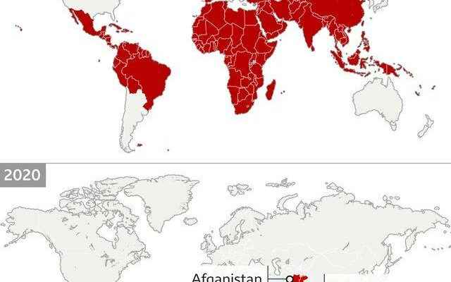 Polio virus spotted in London What is polio and how