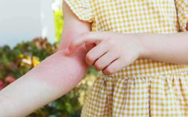 8 important symptoms of rheumatic diseases in children