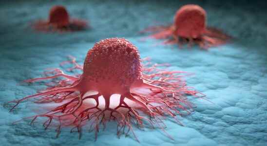 Cancer a blood test to determine the preferred treatment