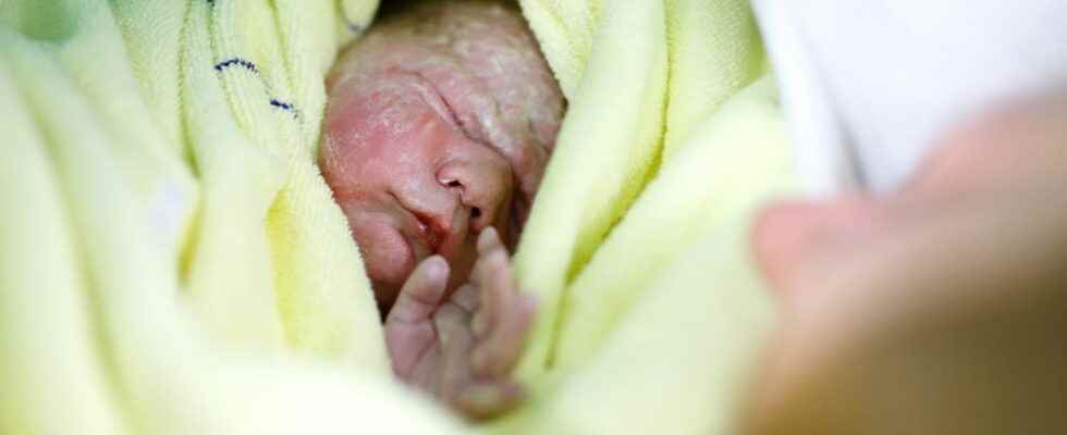 Indian baby born with 4 arms and 4 legs