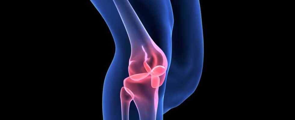 Septic arthritis what is it