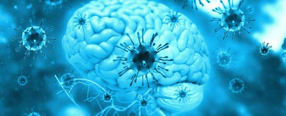 Alzheimers disease could appear following an infection by a very