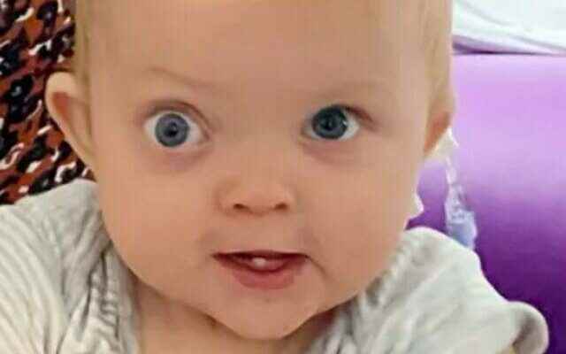 Parents warned The change she noticed in her babys eyes