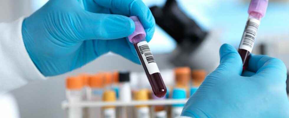 A blood test would allow the early detection of more