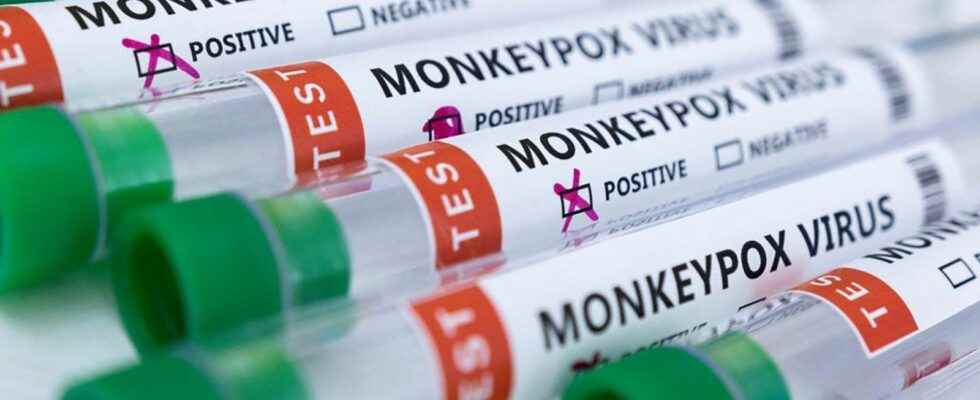 Monkeypox confirmed by SW Public Health but waning amid vaccine