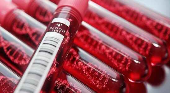 People with blood group A are more likely to have