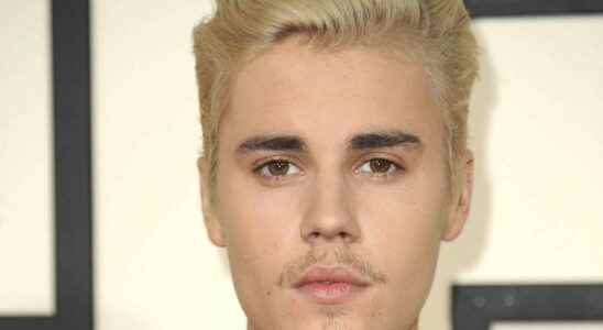 Ramsay Hunt syndrome Justin Bieber stops his tour