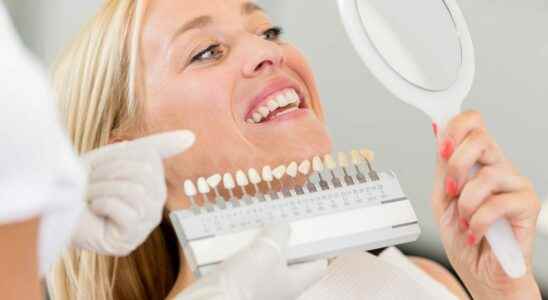 Teeth whitening choosing the right method to limit the risks