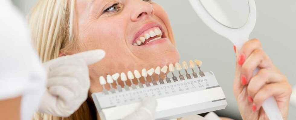 Teeth whitening choosing the right method to limit the risks