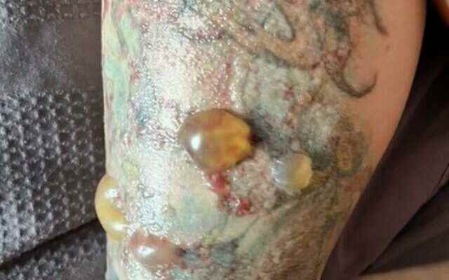 Think twice before you do The unknown face of tattoo