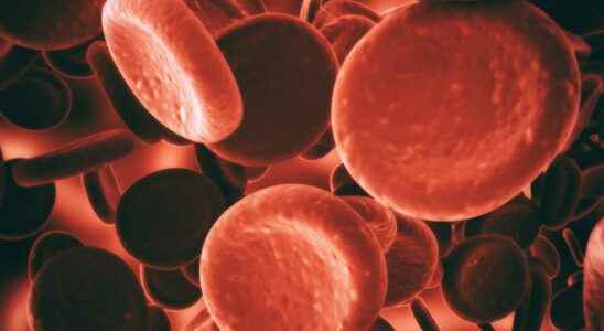 What are the different blood diseases