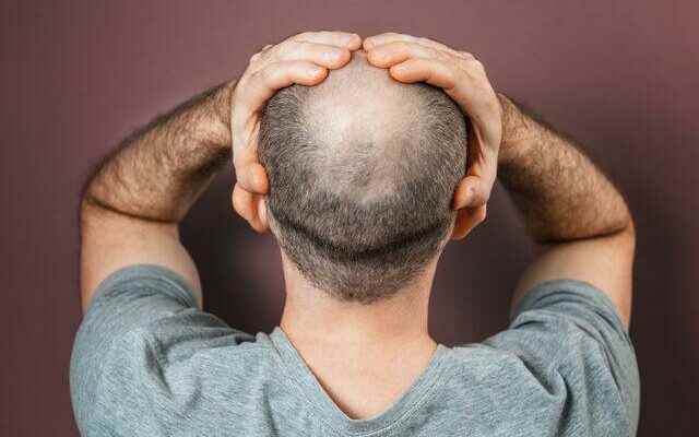 It works one hundred percent Baldness becomes history Cure found