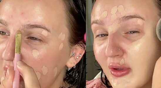 The sticky method the trendy technique to camouflage your acne