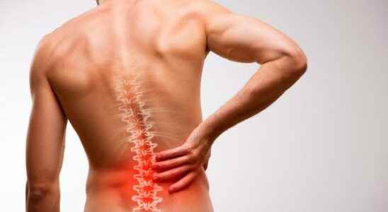 3 critical causes of back pain that you may not