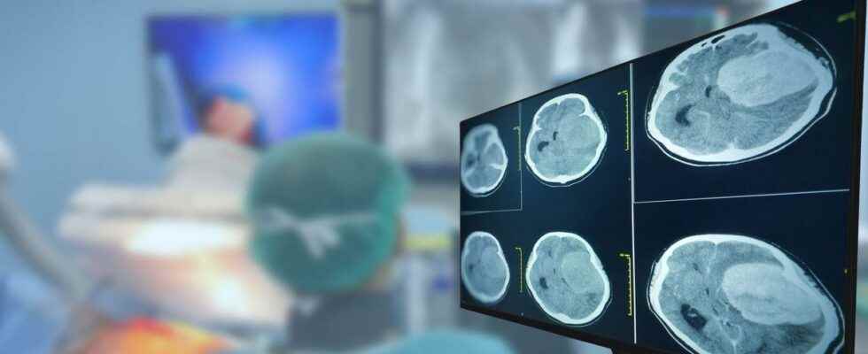 An effective vaccine against glioblastoma