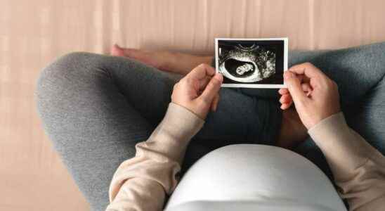 Miscarriage a delay before getting pregnant again is not useful