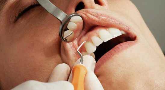 Oral diseases affect nearly half of the worlds population