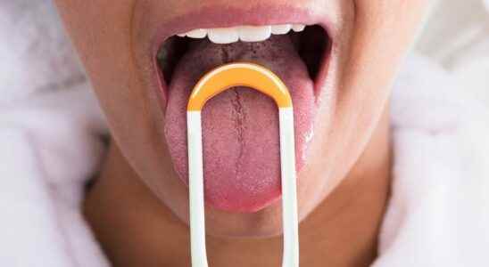 Tongue scraping is this Tik Tok trend useful for oral