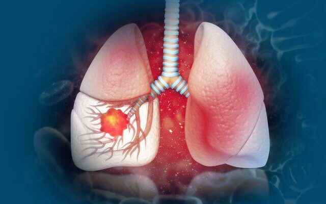 You can lower your risk of lung cancer by taking