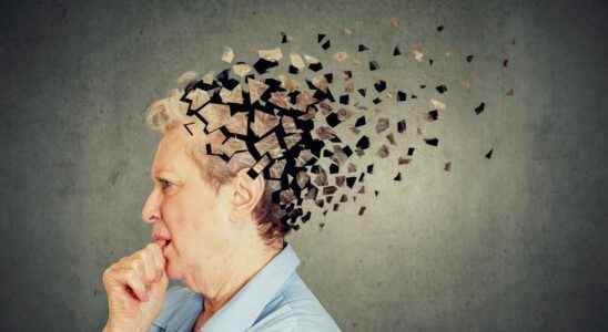 Alzheimers a blood test allows a diagnosis before the first