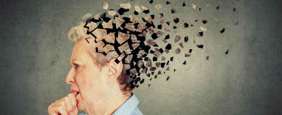 Alzheimers a blood test allows a diagnosis before the first