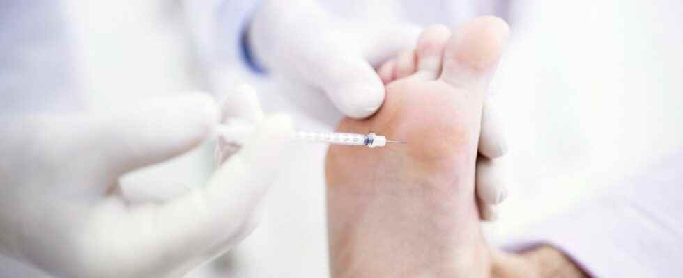 Botox of the feet a phenomenon that is happening in