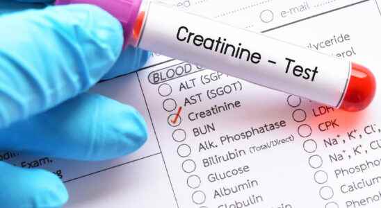 Cockroft and Gault Formula Calculating Creatinine Clearance