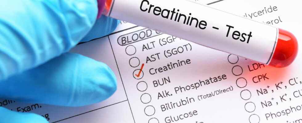 Cockroft and Gault Formula Calculating Creatinine Clearance