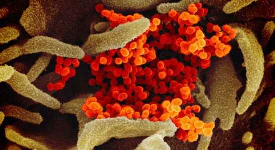 Covid 19 BQ11 the sub variant that threatens the immunocompromised