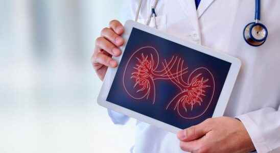 Kidney transplant the shortage of Belatacept entails real risks for