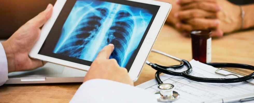 Soon an electronic nose capable of detecting lung cancer