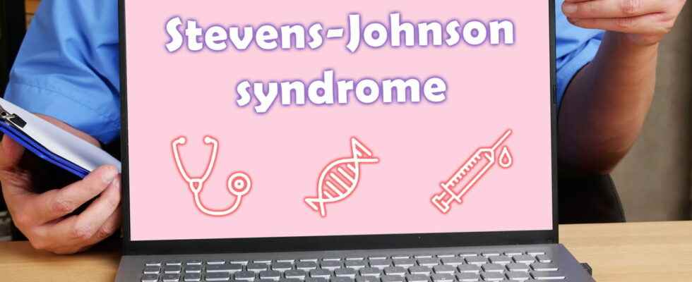 Stevens Johnson syndrome symptoms what is it