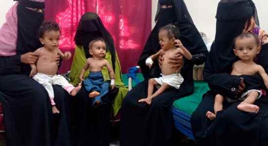 Yemen war devastating for children