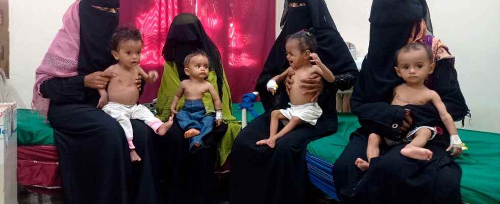 Yemen war devastating for children