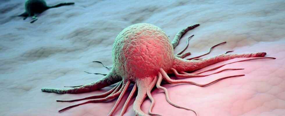 Brain cancer a study turns cancer cells into a real