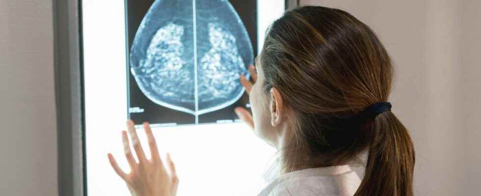 Breast cancer this risk factor that is too little known