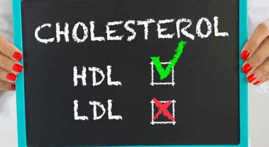 Cholesterol total LDL HDL high low what is it