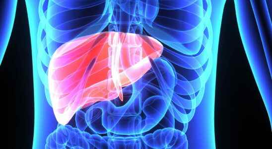 How to treat hepatomegaly liver