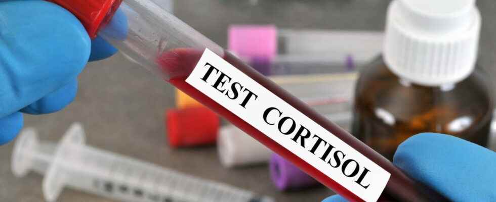 Low high cortisol in the blood standards what to do