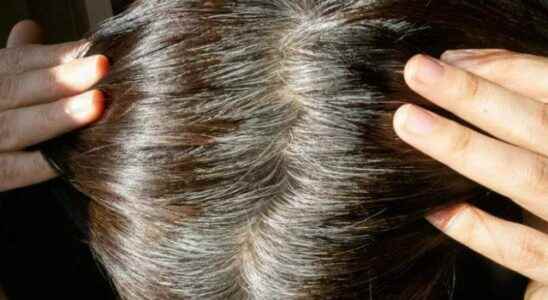 You will completely get rid of white hair naturally We