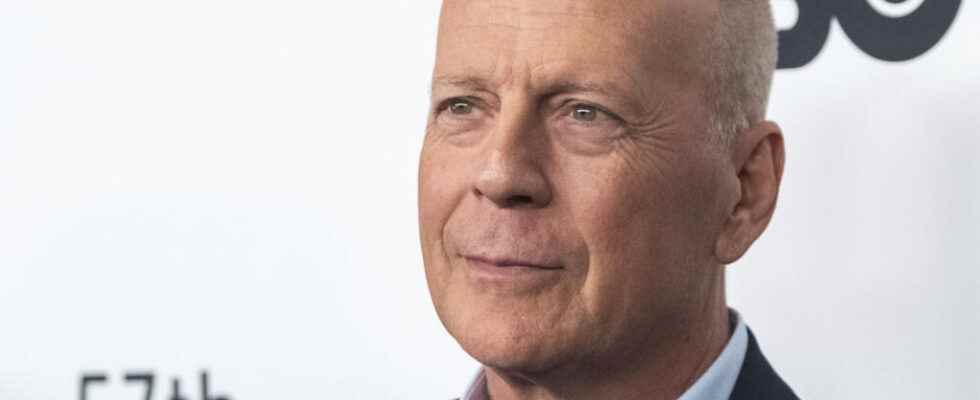 American actor Bruce Willis suffers from an incurable form of