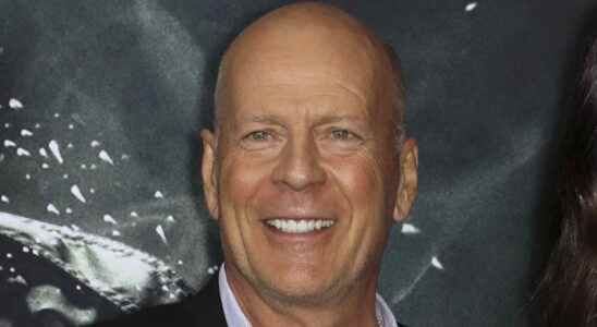 Bruce Willis suffering from dementia how is the actor