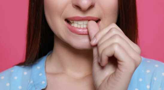 Dermatophagia causes how to stop eating your skins