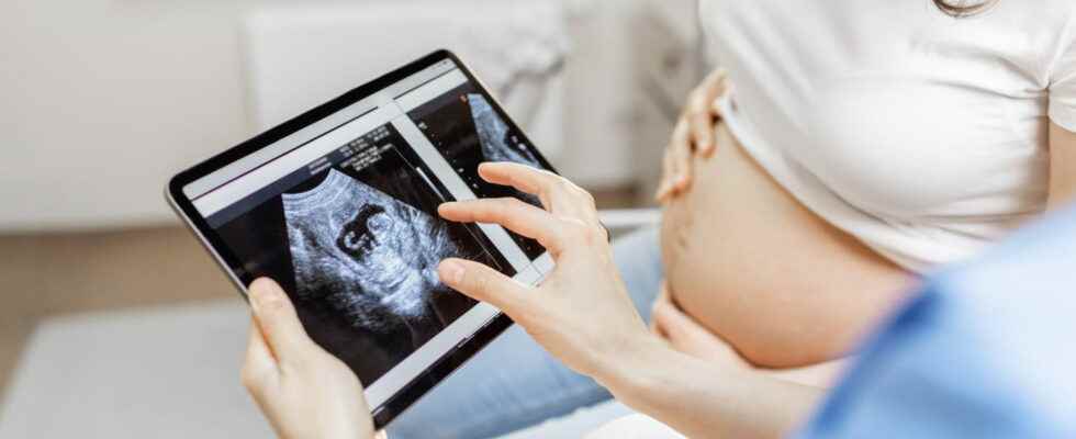 Intrauterine pregnancy symptoms risks what is it