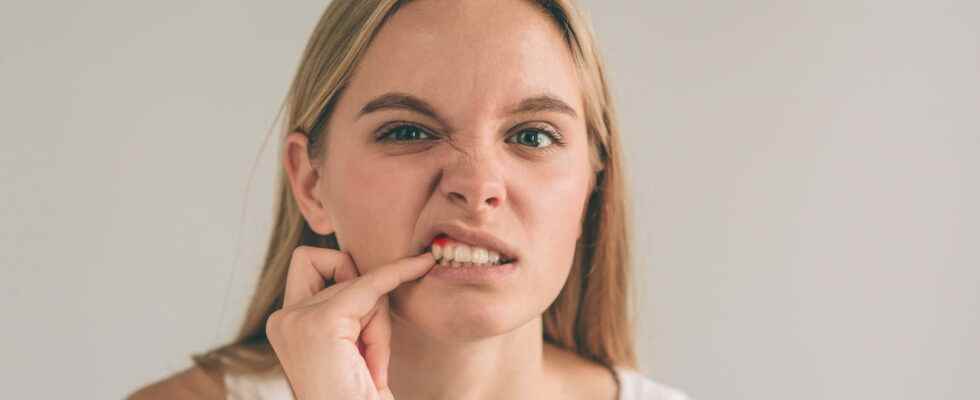 Periodontitis causes symptoms how to treat it