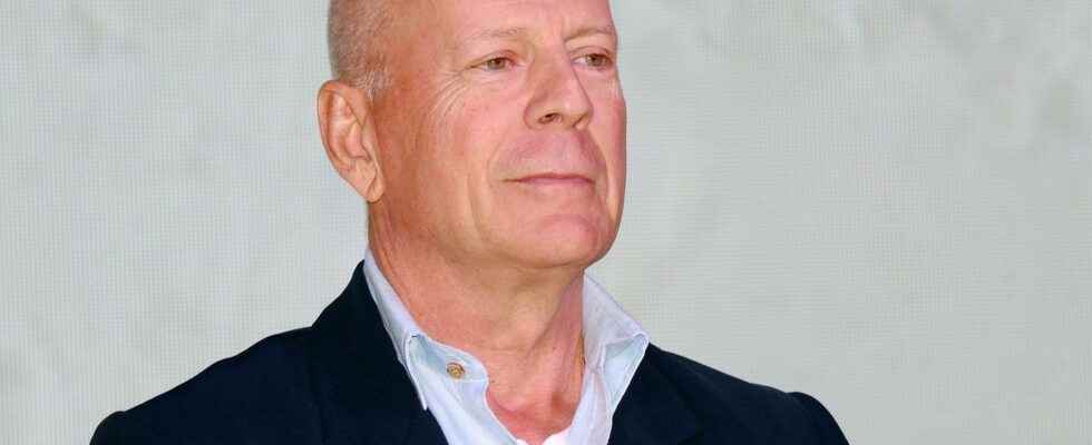 What is frontotemporal dementia this disorder from which Bruce Willis