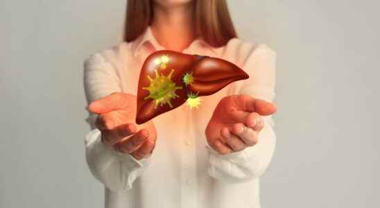 What is the new HCirV 1 virus that infects the liver