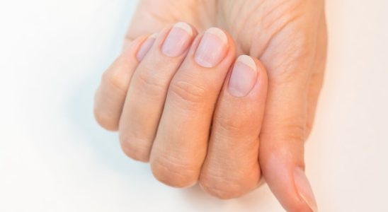 10 nutrition tips to have strong and resistant nails