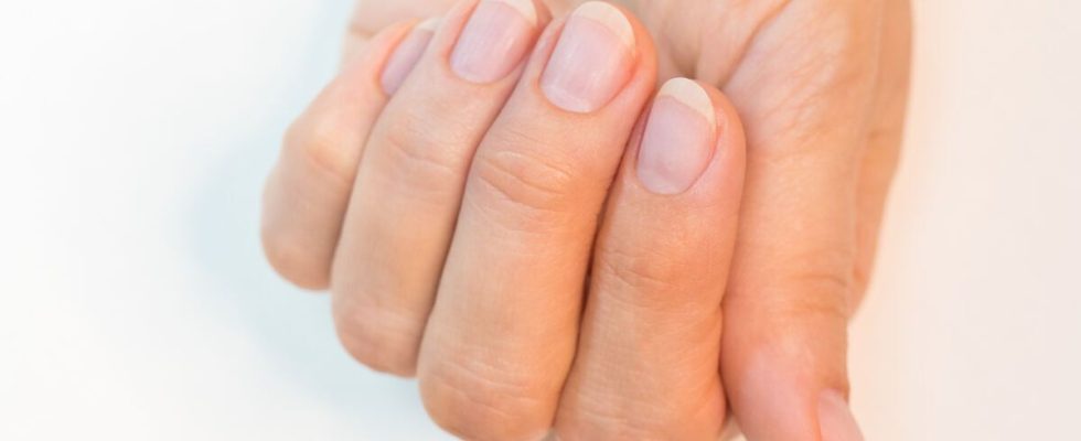 10 nutrition tips to have strong and resistant nails